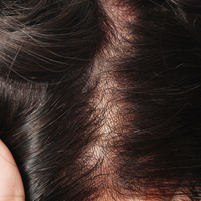 MSSV | Sistema de cabello invisible de 0.02 mm de grosor con bucle en V para hombres