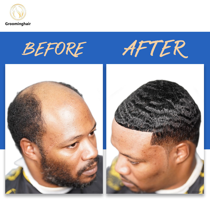 UNIDADE DE CABELO MASCULINO DE PELE FINA POLI 10MM ONDA