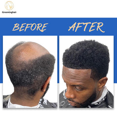 Substituição de cabelo masculino de 4 mm de pele completa AFRO POLY para cabelo africano